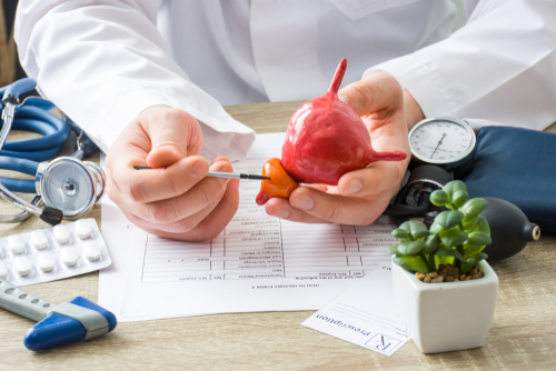 Tumore alla prostata: scoperta una firma molecolare della malattia