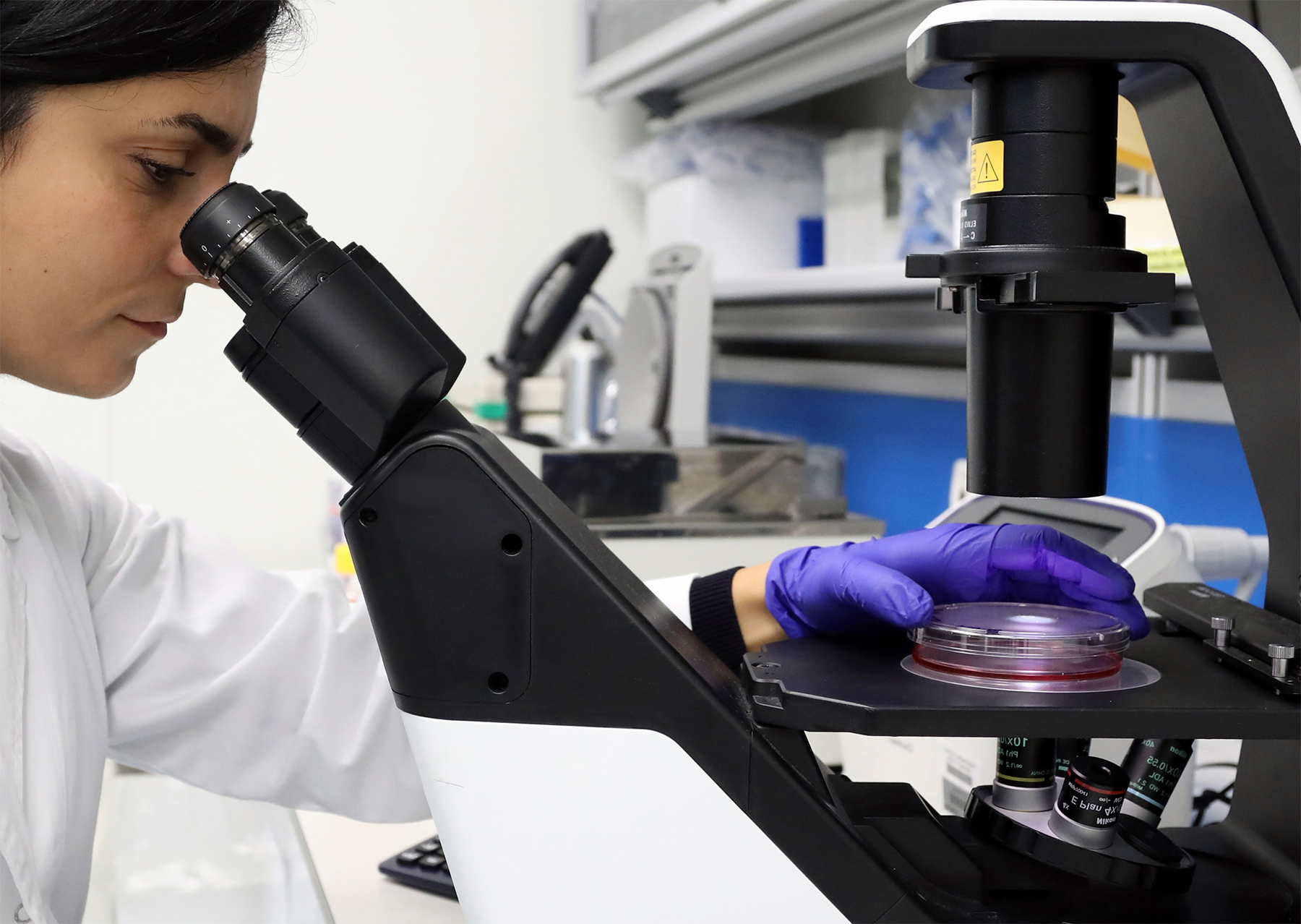 Analisi del sague, CytoDiffusion: “l’IA che individua anomalie invisibili agli ematologi”