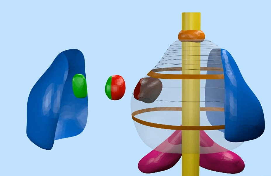 Tumore alla prostata: con IA e realtà aumentata interventi robotici più efficaci