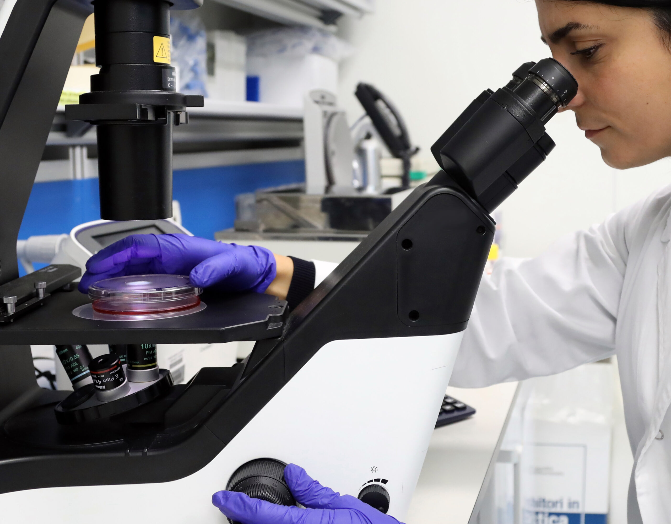 “Malattia del bacio” e sclerosi multipla nei bambini, confermato il legame