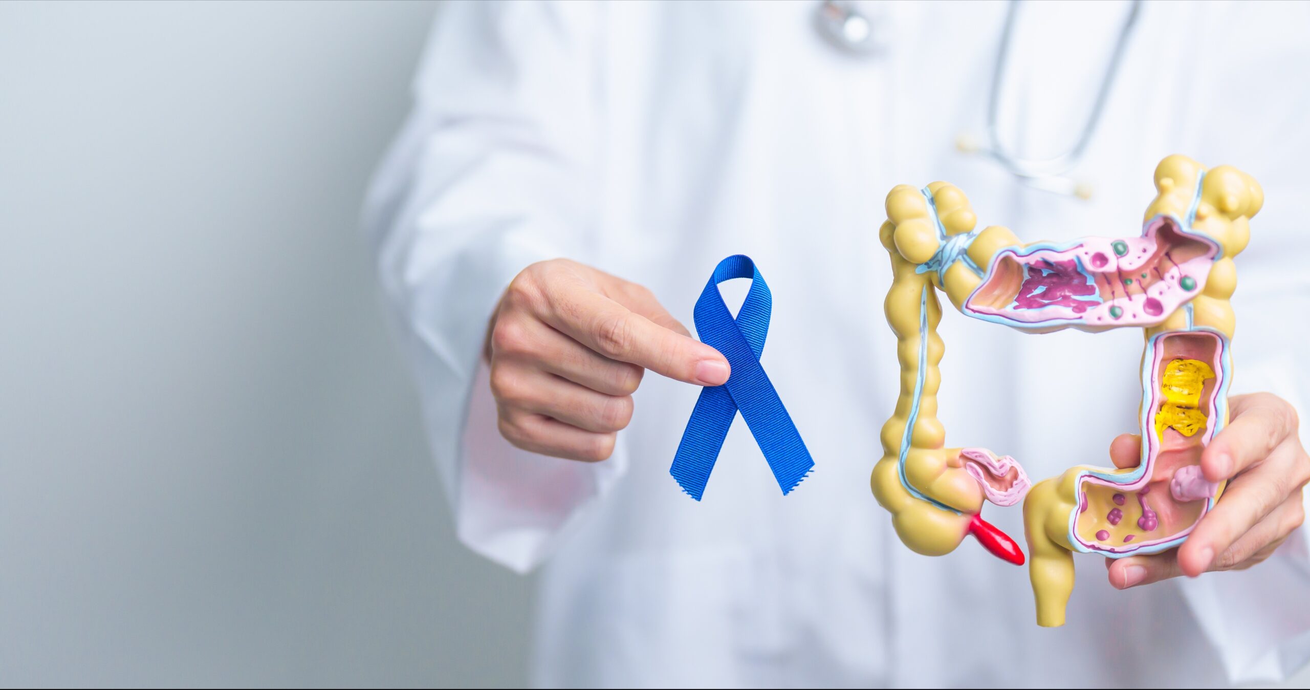 Tumore del retto. Studio italiano ‘NO-CUT’ dimostra che un paziente su quattro può guarire senza chirurgia