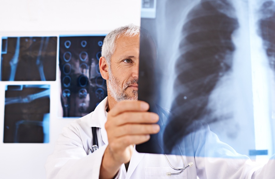 Tumore polmonare: allo IEO primo intervento in Italia senza chirurgia