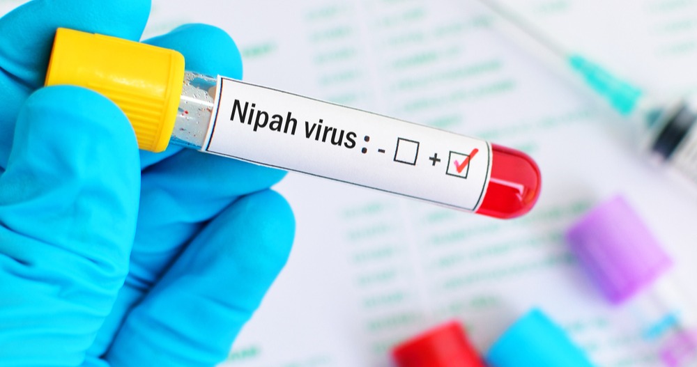 Nipah virus in India, due casi in Bengala Occidentale. Rischio molto basso per l’Europa