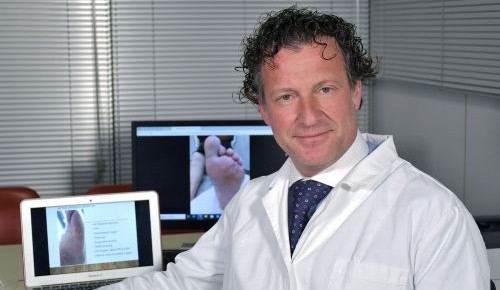 Piede diabetico. Visite gratuite al Policlinico Sassarese e a Villa Elena a Cagliari