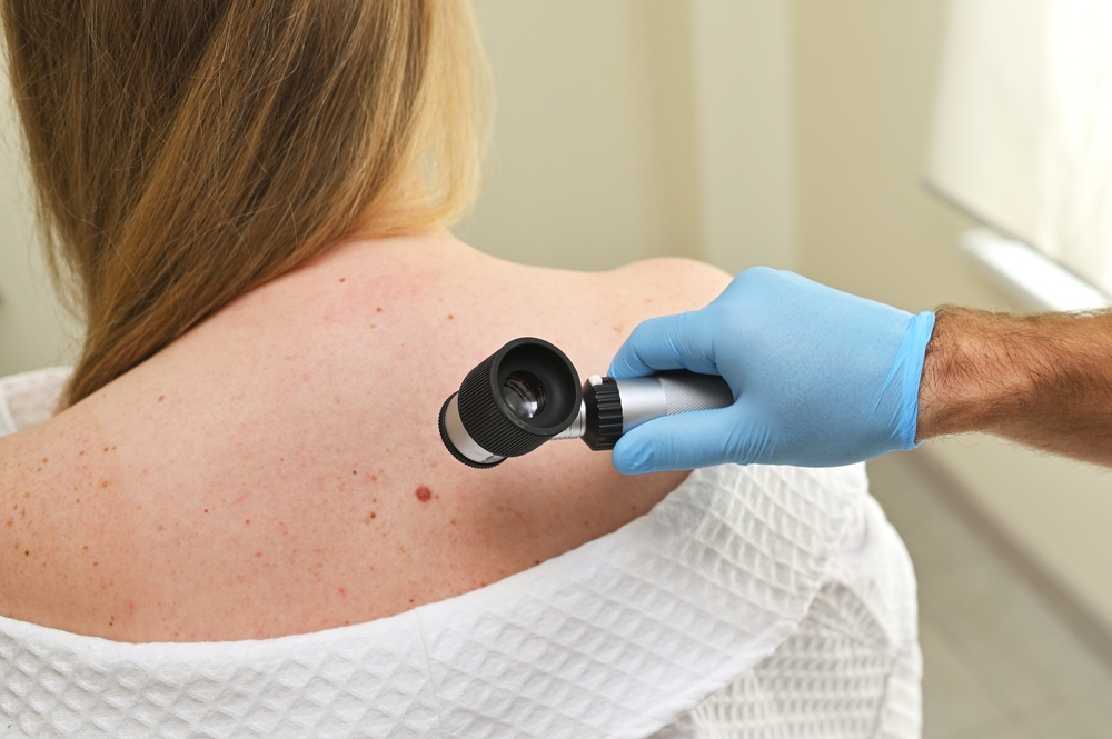 Melanoma, Sidemast: tatuaggi e protezione solare al centro della prevenzione