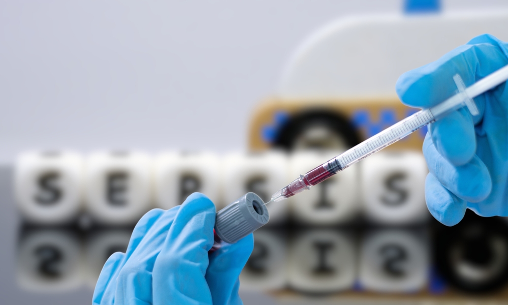 Sepsi, un valore dell’emocromo migliora l’allerta precoce in Pronto Soccorso