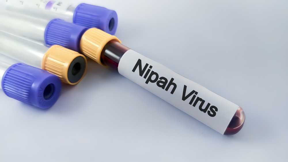 Vaccino anti-Nipah, la scienza prova ad anticipare la prossima minaccia globale