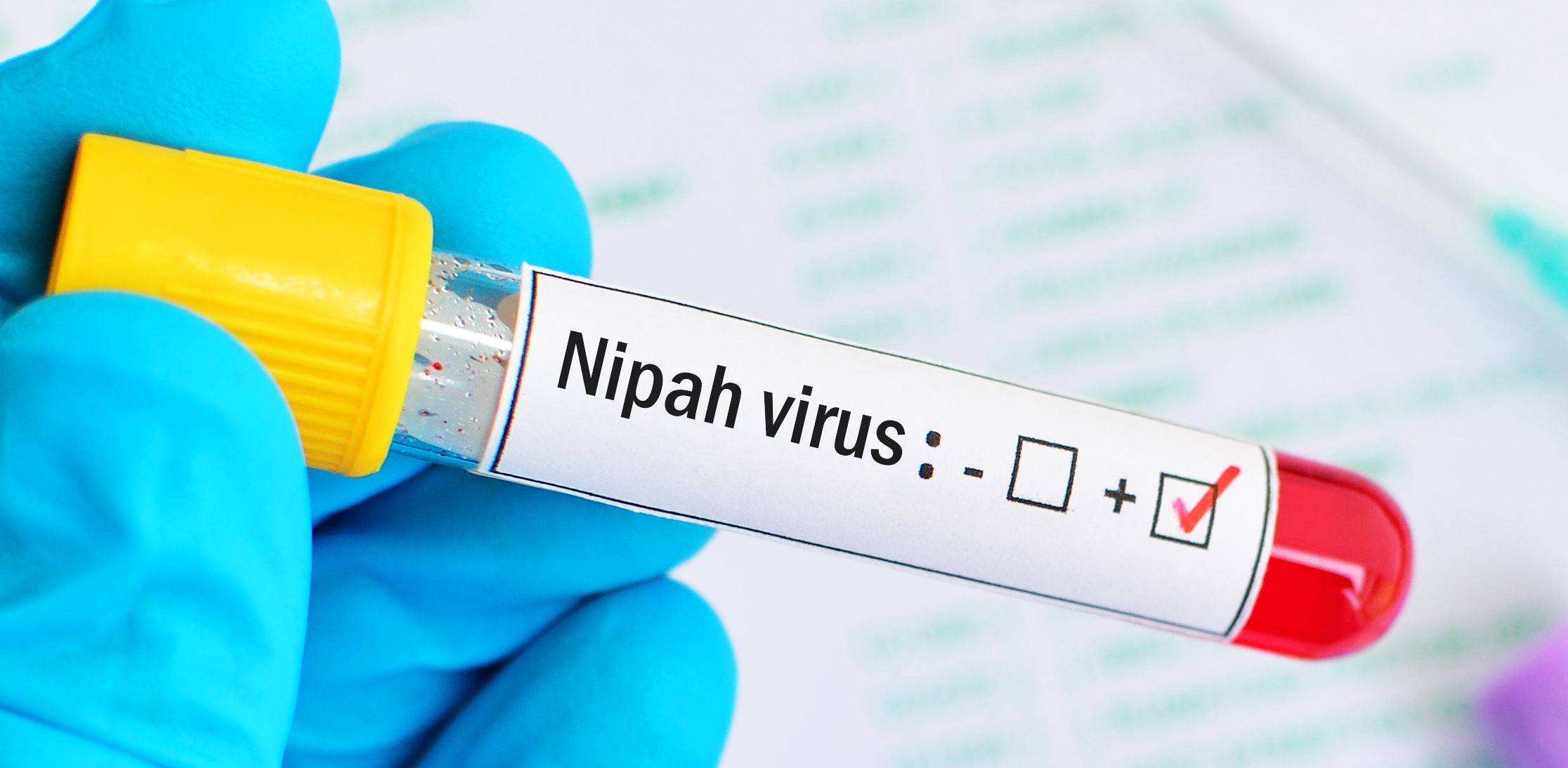 Virus Nipah. Ministero della Salute: “Monitoraggio costante, rischio molto basso per l’Italia”