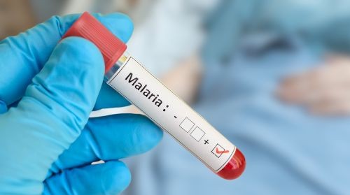 World Malaria Day. Nel 2024 oltre 282 mln di casi e 610mila morti nel mondo. Tanti i progressi, ma anche i rischi nonostante innovazioni e vaccini