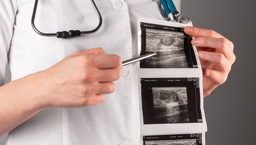 Quando il tumore diventa fluido: la fisica svela l’origine dell’invasività